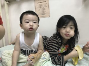 Febrile seizure 4